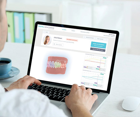  How does Dental Monitoring work?
