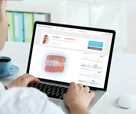  Invisalign® and Dental Monitoring - the perfect match
