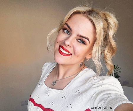 Invisalign® clear aligners